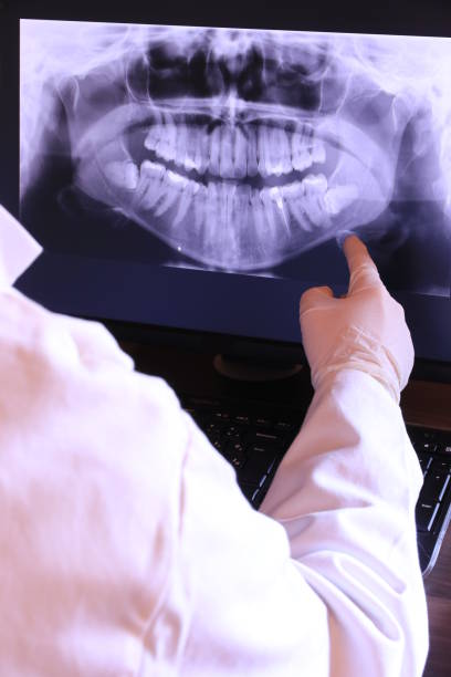 Best Emergency Dentist for Knocked-Out Tooth in Mlstadt, IL