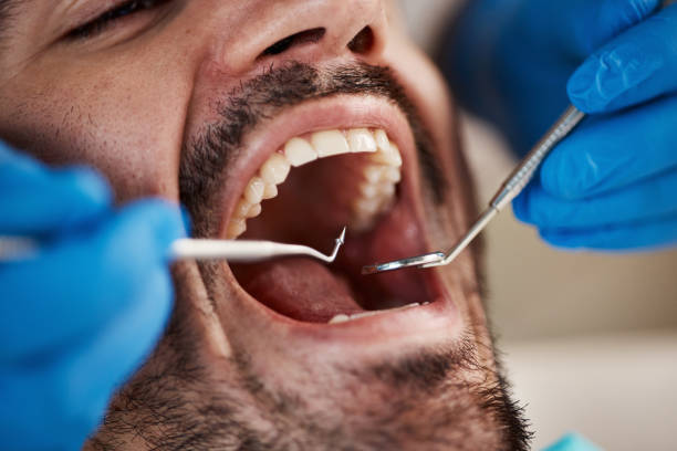 Best Orthodontic Emergency Dentist in Mlstadt, IL