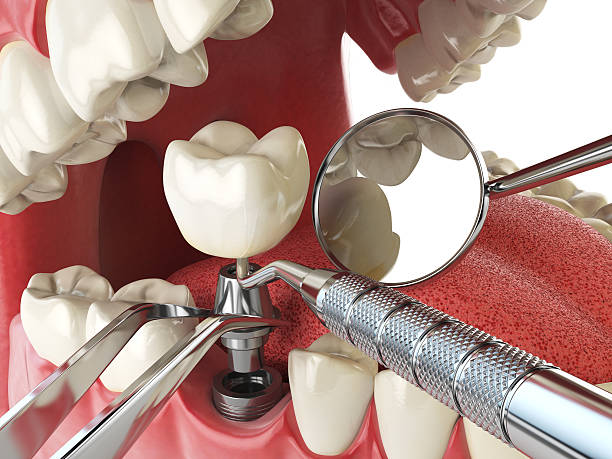 Best Emergency Dental Extractions in Mlstadt, IL